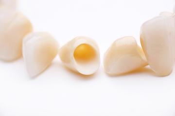 dental crowns | dedham, ma