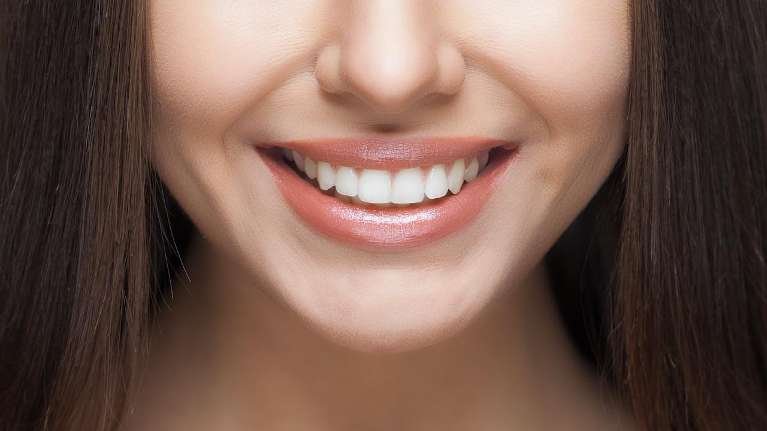 dental implants dedham | woman smiling
