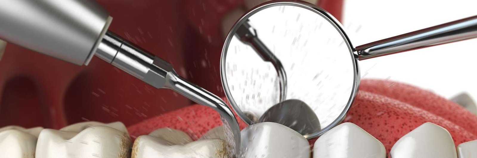 close up of dental tools in mouth | cosmetic dentist dedham ma